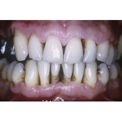 PERIODONTIA