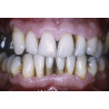 PERIODONTIA
