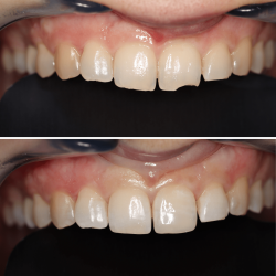 DENTISTERIA ESTÉTICA